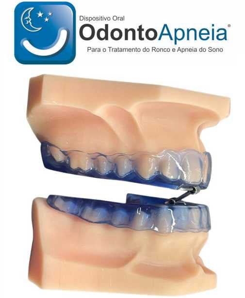 Aparelho intraoral Sistema Odontoapneia, a alternativa ao CPAP para tratamento de ronco e apneia do sono